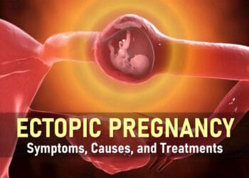 ectopic pregnancy symptoms, treatment, ruptured ectopic pregnancy hcg levels, methotrexate for ectopic pregnancy