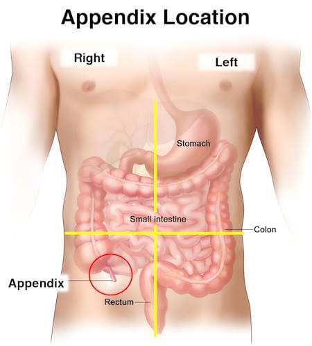 Appendicitis symptoms, What side is your appendix on, appendix pain location