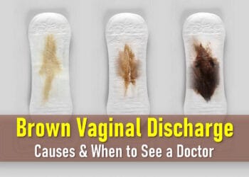 brown discharge 2 weeks after period, light, dark, brown heavy implantation bleeding