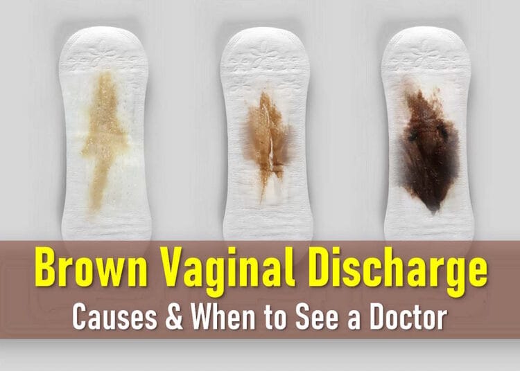 brown discharge 2 weeks after period, light, dark, brown heavy implantation bleeding