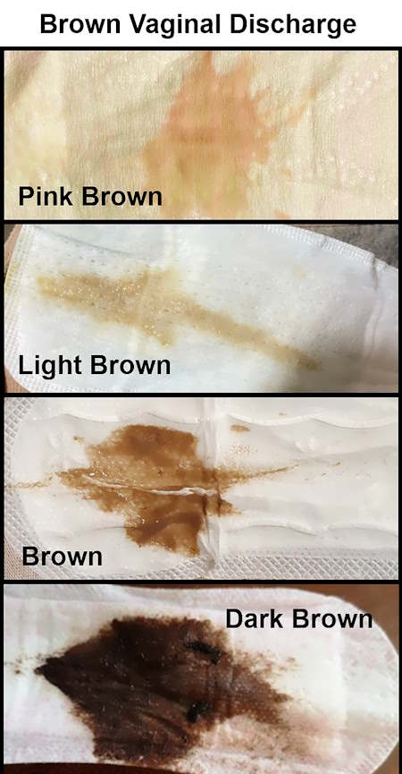 brown discharge before period, brown heavy implantation bleeding, light brown discharge, dark brown