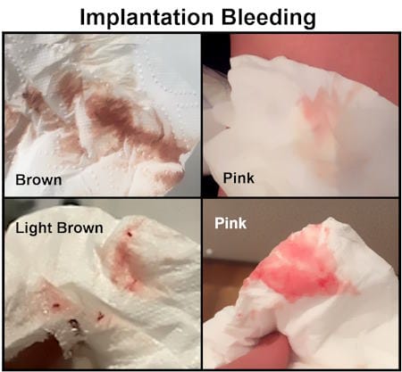 Implantation Bleeding Pictures, Brown Implantation Bleeding pics, actual implantation bleeding, brown heavy implantation bleeding 