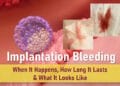 implantation bleeding, when it happens, actual implantation bleeding, what does implantation bleeding look like, implantation bleeding pictures