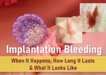 implantation bleeding, when it happens, actual implantation bleeding, what does implantation bleeding look like, implantation bleeding pictures
