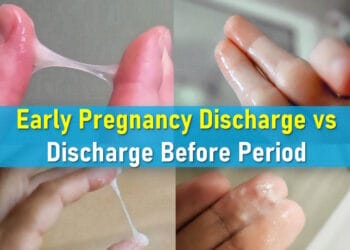 discharge before period vs early pregnancy, white discharge before period sign of pregnancy, egg white, thick white, pictures