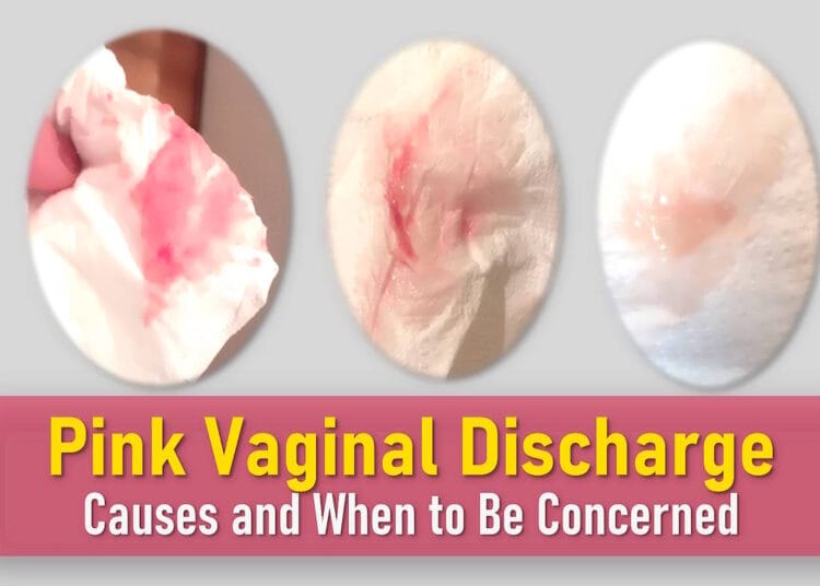 pink discharge, light pink discharge, pink discharge after period, what does pink discharge mean, implantation pink discharge