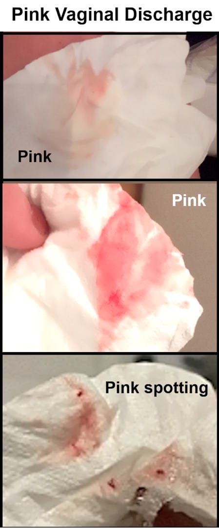 light pink discharge, pink discharge when I wipe, why is my discharge pink, pink vaginal discharge, pinkish brown discharge