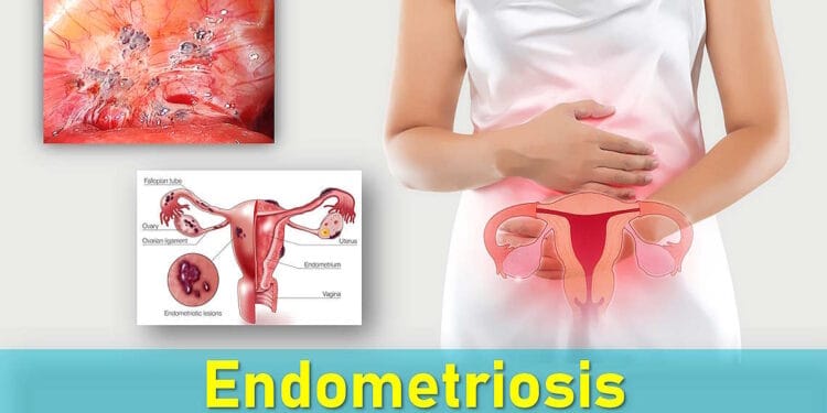 Pink Discharge: What Causes It and When It’s a Cause for Concern