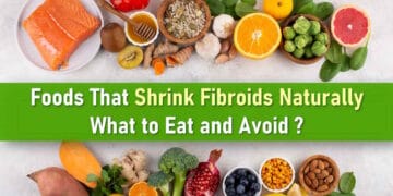 fibroids in uterus, foods for shrinking fibroids, uterine fibroids medication treatment, signs of fibroids breaking down